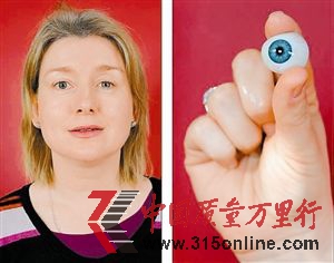 斯通左眼摘除后安裝了假體眼球。 斯通左眼摘除后安裝了假體眼球。
